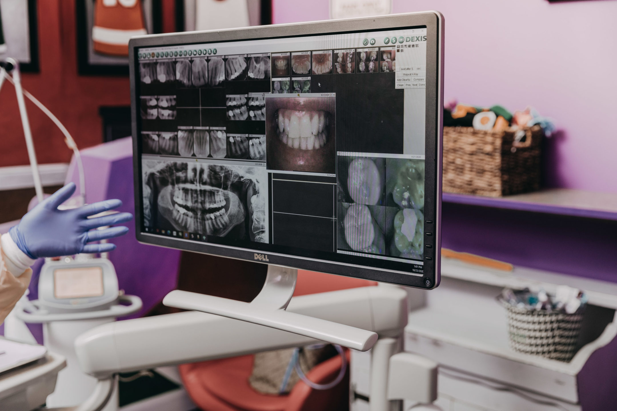 A gloved hand points to an image of a patient’s teeth on a screen over the dental chair. 