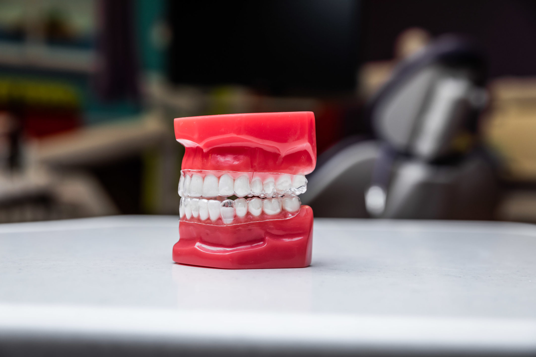 A set of clear aligners on a model of teeth. 