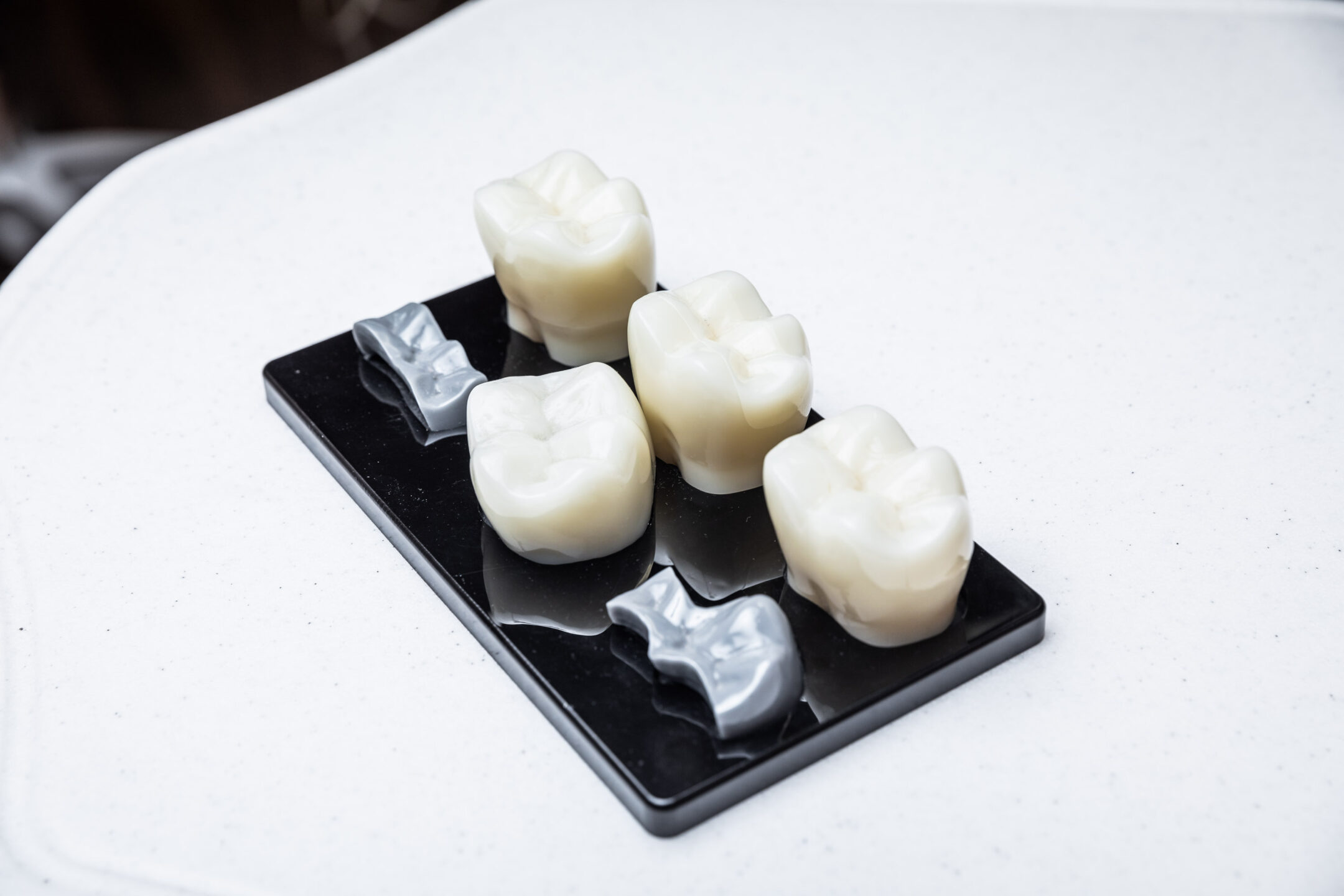 Models of white teeth on a black dental tray. 